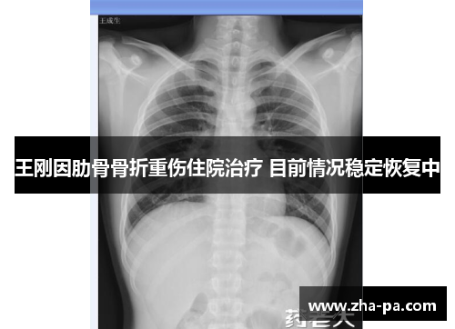 王刚因肋骨骨折重伤住院治疗 目前情况稳定恢复中